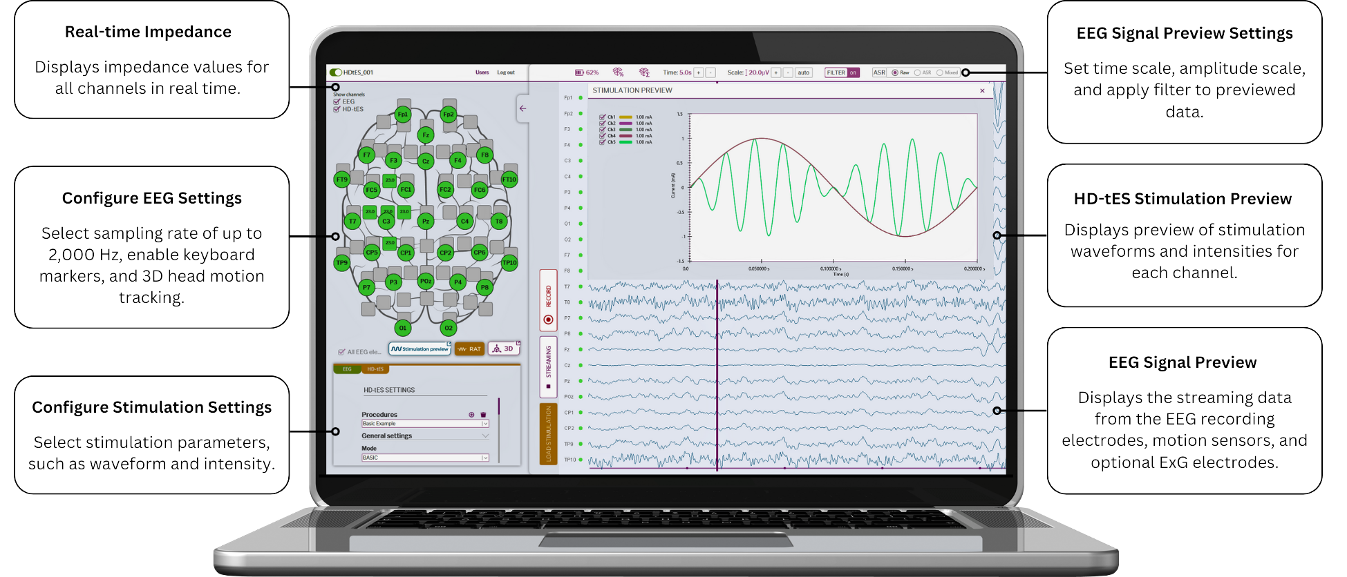 EEG + HD-tES 整合系統｜M×N-GO EEG｜無線電刺激｜無線EEG｜多頻道